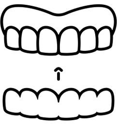 Invisalign 