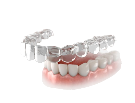 Invisalign4