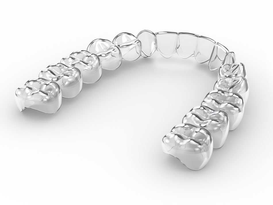Invisalign5 Invisalign5